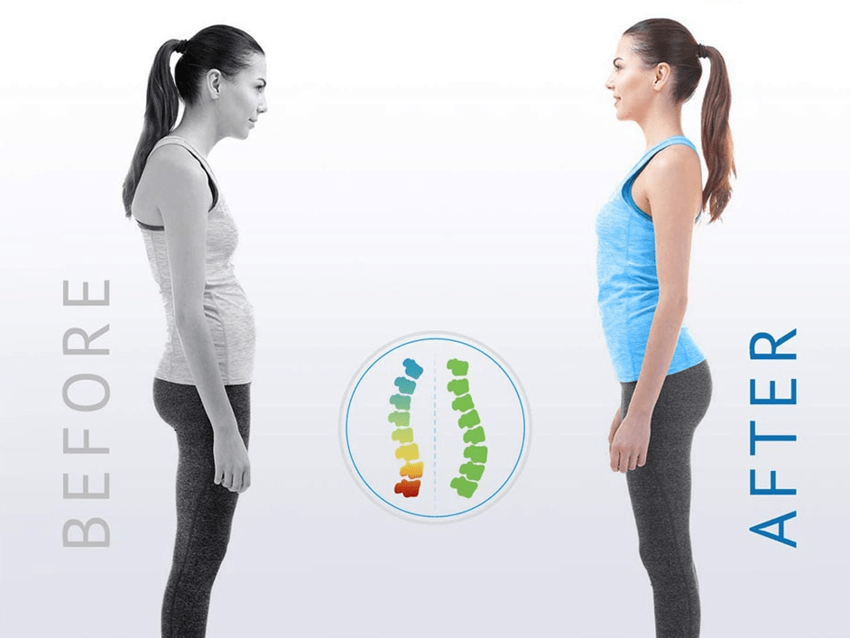 Posture Corrector - Nara's Shop